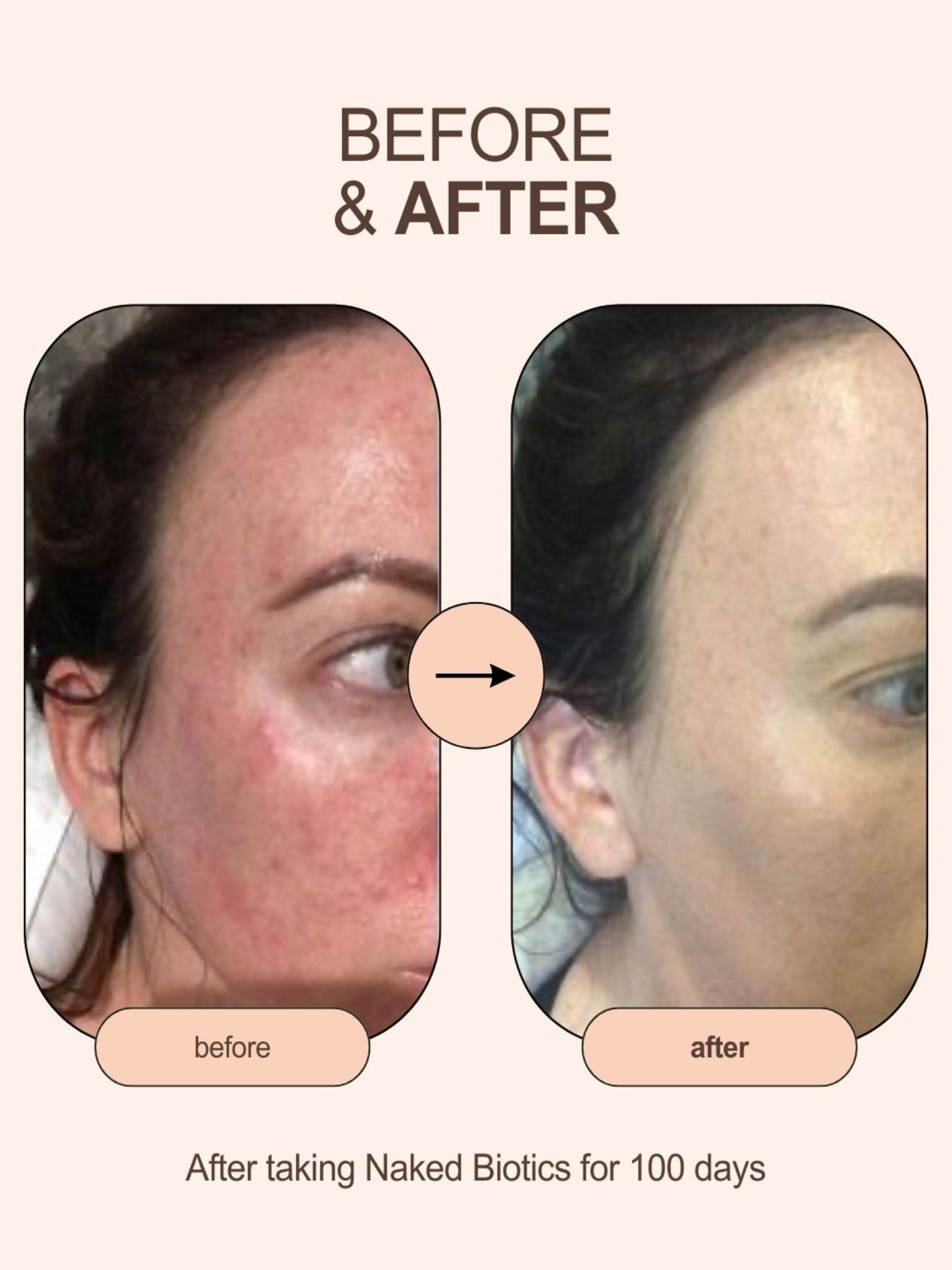 Restore balance to your gut - Naked Biotics